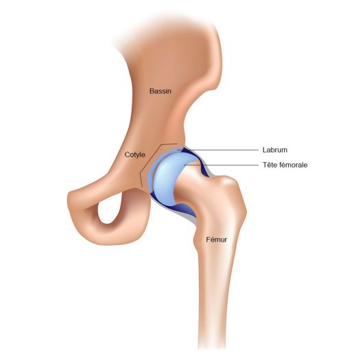 Arthrose de la hanche - Symptômes et traitement de l'arthrose